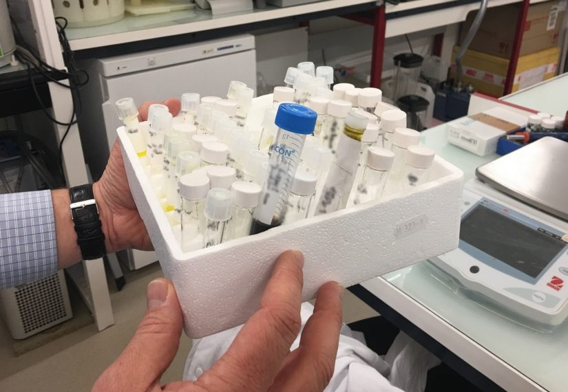 Des plantes pour empoisonner Alzheimer et Parkinson 3