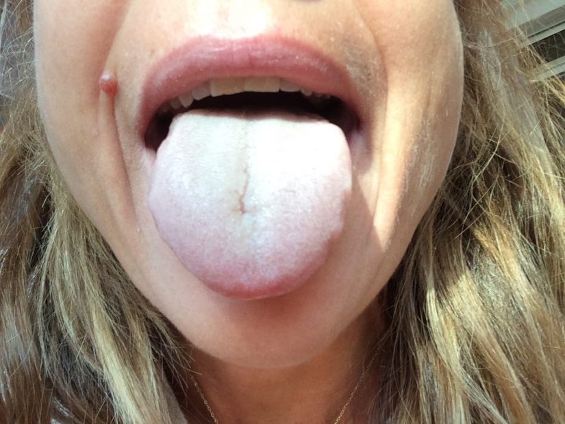 Jeûner pour retrouver sa vitalité : info ou intox ?