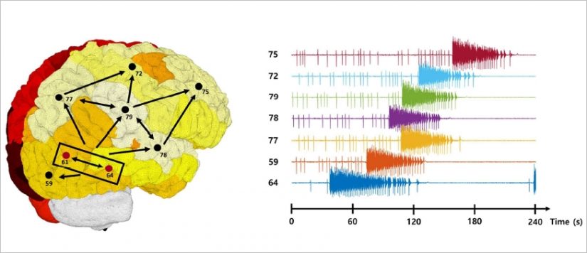 Un essai clinique piloté depuis Marseille pour décrypter l’épilepsie 4