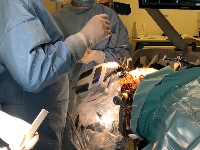 Un bras robotisé pour soigner l’épilepsie 2