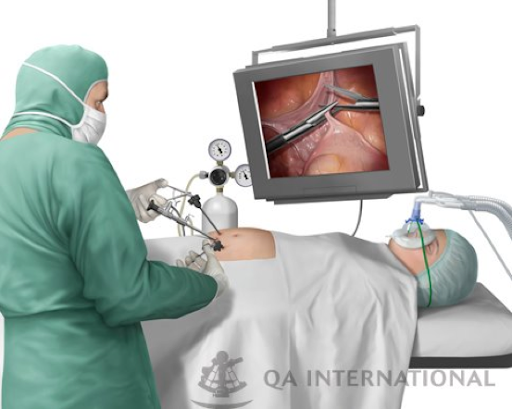 Chirurgie sans cicatrice en passant par les orifices naturels 11