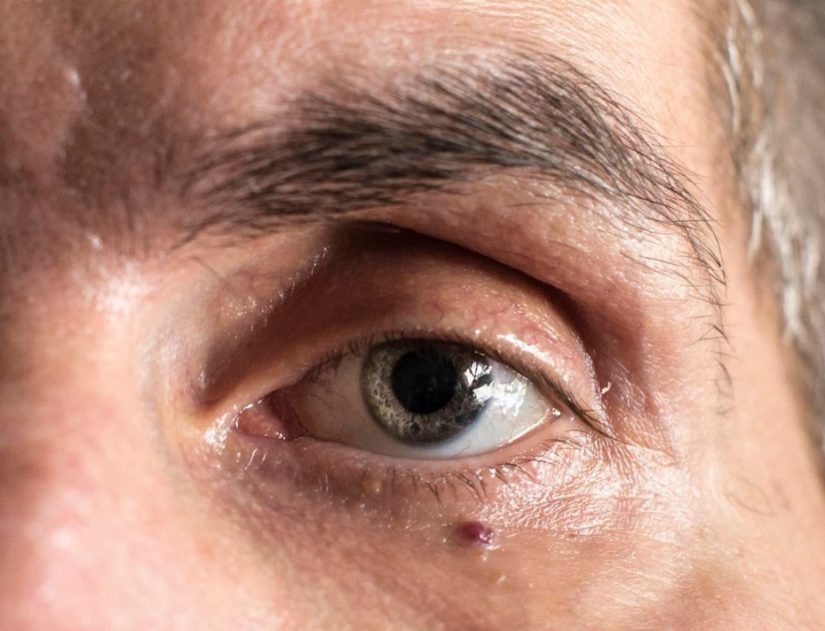 aide-maladie-charcot-sla