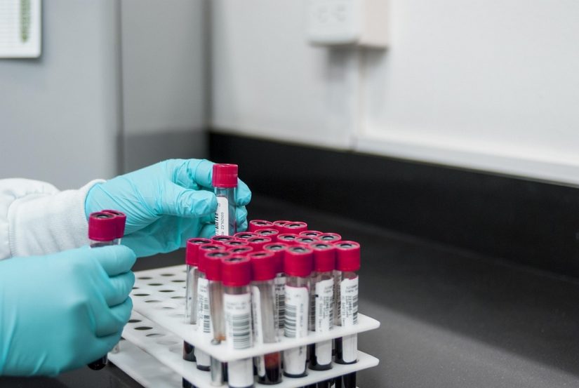test-cholesterol-genetique-familiale